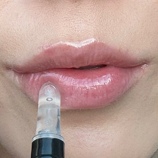 Espera de 5 a 10 minutos