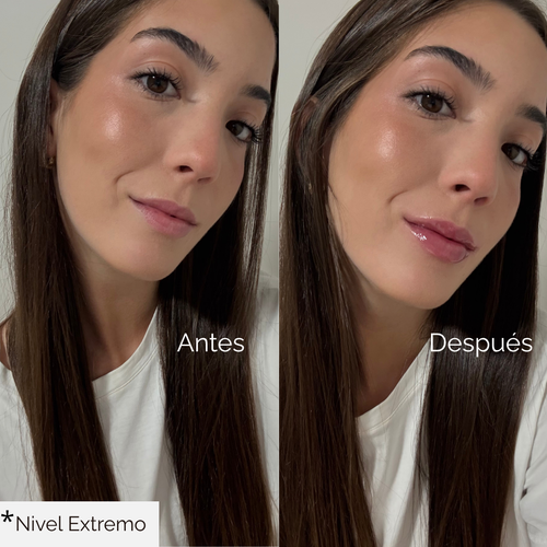 Voluminizador de Labios