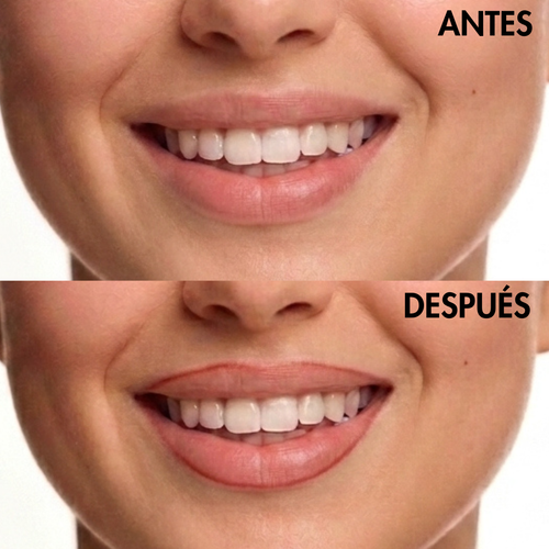Contorno Peel-Off